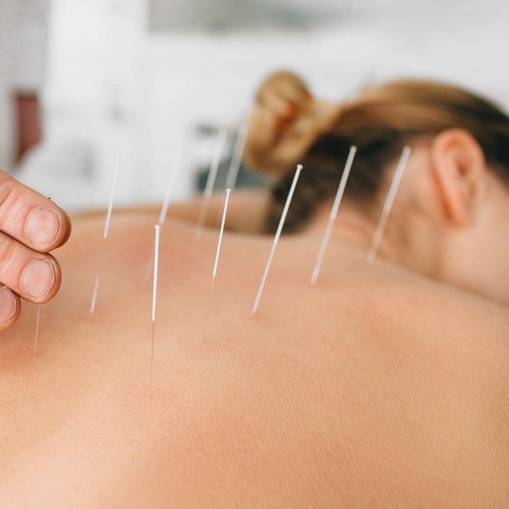 all about acupuncture treatment